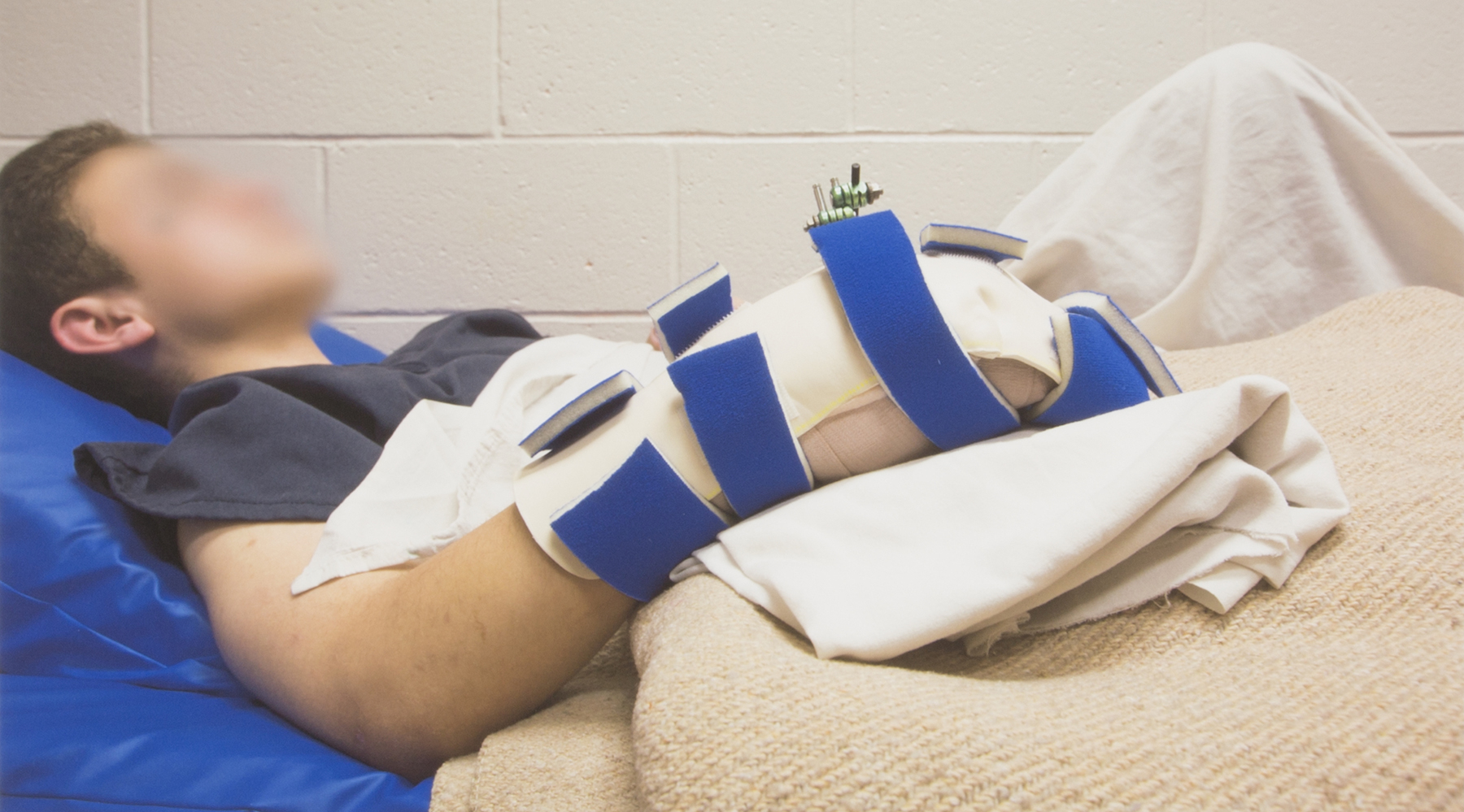 An injured man lays on a gurney.